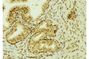 ABIN6277270 at 1/100 staining Mouse colon tissue by IHC-P. (VEGFC antibody  (Internal Region))