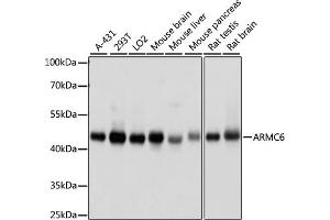 Western blot analysis of extracts of various cell lines, using  antibody (ABIN7265674) at 1000 dilution. (ARMC6 antibody  (AA 1-220))