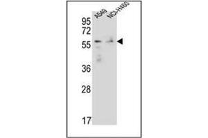 Western blot analysis of FOXN1 Antibody (Center) in A549,NCI-H460 cell line lysates (35ug/lane). (FOXN1 antibody  (Middle Region))