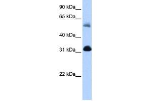 WB Suggested Anti-OXCT1 Antibody Titration:  0. (OXCT1 antibody  (N-Term))