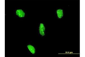 Immunofluorescence of monoclonal antibody to LHX3 on HeLa cell.
