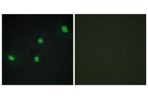 Immunofluorescence (IF) image for anti-Cell Division Cycle Associated 4 (CDCA4) (Internal Region) antibody (ABIN1850258) (CDCA4 antibody  (Internal Region))