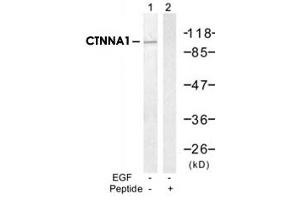Western blot analysis of extract from A-431 cells, untreated or treated with EGF (200ng/ml, 30min), using CTNNA1 polyclonal antibody (Cat # PAB12225, Lane 1 and 2). (CTNNA1 antibody  (Ser641))