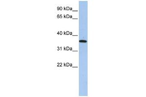 WB Suggested Anti-FAM84A Antibody Titration: 0. (FAM84A antibody  (N-Term))