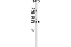 ZMAT2 Antibody (C-term) western blot analysis in T47D cell line lysates (35 µg/lane).