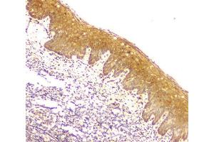 IHC analysis of MCUR1 using anti-MCUR1 antibody (ABIN6719261). (CCDC90A antibody)