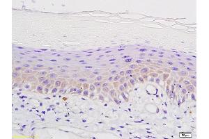 Formalin-fixed and paraffin embedded mouse skin labeled with Anti-°-Opioid receptor Polyclonal Antibody, Unconjugated (ABIN701755) followed by conjugation to the secondary antibody and DAB staining (Mu Opioid Receptor 1 antibody  (AA 165-270))