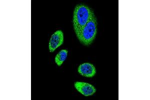 Confocal immunofluorescent analysis of PTGS2 Antibody (Center ) (ABIN655500 and ABIN2845016) with A549 cell followed by Alexa Fluor® 489-conjugated goat anti-rabbit lgG (green). (PTGS2 antibody  (AA 363-391))