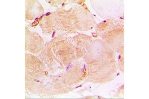 Immunohistochemical analysis of cTnI staining in human heart formalin fixed paraffin embedded tissue section.