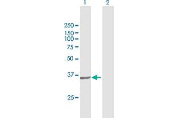 PIH1D1 antibody  (AA 1-290)