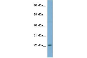 WB Suggested Anti-MFAP2 Antibody Titration: 0. (MFAP2 antibody  (N-Term))