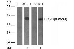 Image no. 2 for anti-3-phosphoinositide Dependent Protein Kinase-1 (PDPK1) (pSer241) antibody (ABIN196616)