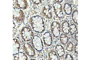 IHC analysis of Prohibitin/PHB using anti-Prohibitin/PHB antibody (ABIN7599170).