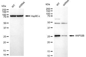 Western blotting analysis using ANP32B antibody (ABIN7797448). (Recombinant ANP32B antibody)