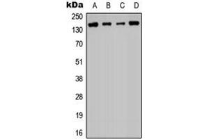 Western blot analysis of Histone Deacetylase 6 expression in PC3 (A), Jurkat (B), NIH3T3 (C), rat liver (D) whole cell lysates. (HDAC6 antibody  (N-Term))