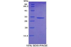 SDS-PAGE (SDS) image for Diacylglycerol Kinase, alpha 80kDa (DGKA) (AA 312-557) protein (His tag) (ABIN2124621) (DGKA Protein (AA 312-557) (His tag))