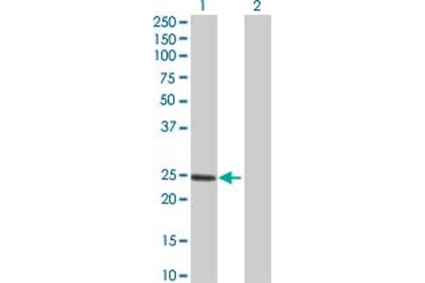 DNAJC5B antibody  (AA 1-199)