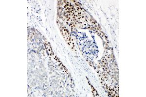 Immunohistochemistry (IHC) image for anti-Tumor Protein P63 (TP63) (AA 664-680), (C-Term) antibody (ABIN3044067)