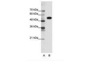 Image no. 1 for anti-Chloride Channel Kb (CLCNKB) (N-Term) antibody (ABIN6735463) (CLCNKB antibody  (N-Term))