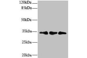 Western blot All lanes: CNOT9 antibody at 6 μg/mL Lane 1: HepG2 whole cell lysate Lane 2: Mouse small intestine tissue Lane 3: Mouse spleen tissue Secondary Goat polyclonal to rabbit IgG at 1/10000 dilution Predicted band size: 34, 37, 30 kDa Observed band size: 34 kDa (RQCD1 antibody  (AA 1-258))