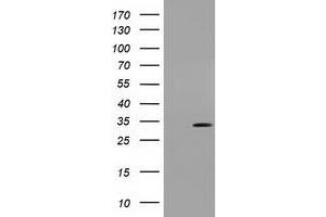Western Blotting (WB) image for anti-Uridine-Cytidine Kinase 1 (UCK1) antibody (ABIN1501666) (UCK1 antibody)