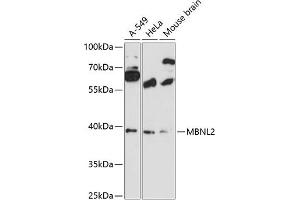 Western blot analysis of extracts of various cell lines, using MBNL2 antibody (ABIN6132336, ABIN6143603, ABIN6143604 and ABIN6216609) at 1:3000 dilution. (MBNL2 antibody  (AA 160-260))