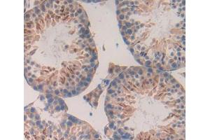 Figure. (LEFTY2 antibody  (AA 247-358))