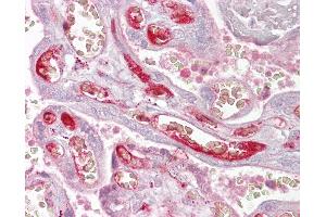 Anti-PPP2R3A antibody IHC of human placenta. (PPP2R3A antibody  (AA 179-228))