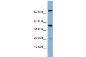 RWDD1 抗体  (AA 71-120)
