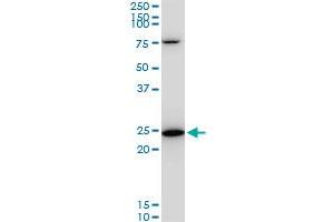 TPT1 monoclonal antibody (M06), clone 2A3. (TPT1 antibody  (AA 35-138))