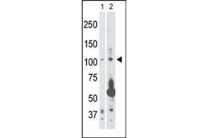 Image no. 1 for anti-Mitogen-Activated Protein Kinase Kinase Kinase 14 (MAP3K14) (Middle Region) antibody (ABIN360384) (MAP3K14 antibody  (Middle Region))