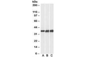 Western blot testing of human [A], mouse [B] and rat [C] heart lysates with Lactate Dehydrogenase B antibody at 0. (LDHB antibody)