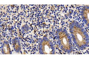 Immunohistochemistry (IHC) image for anti-BCL2-Like 11 (Apoptosis Facilitator) (BCL2L11) (AA 2-120) antibody (ABIN7430234)