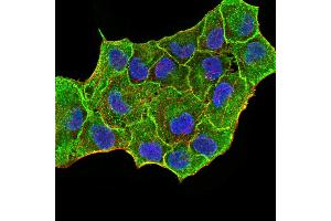 Immunofluorescence (IF) image for anti-Keratin 5 (KRT5) (AA 258-357) antibody (ABIN5542459)