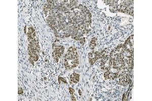 IHC analysis of PARP using anti-PARP antibody (ABIN7602278). (PARP1 antibody  (AA 670-858))