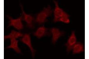 OR6C70 antibody  (C-Term)