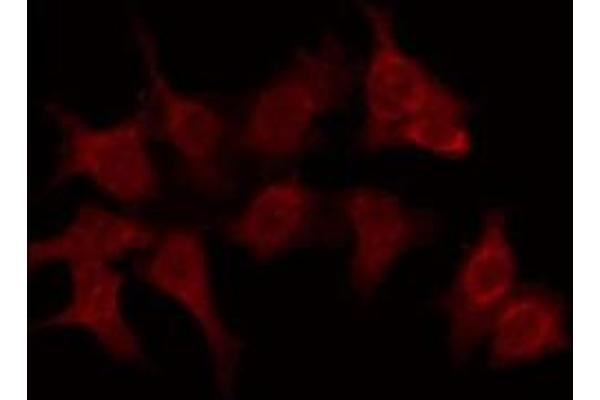 OR6C70 antibody  (C-Term)