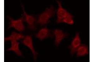 ABIN6276100 staining Hela by IF/ICC. (OR6C70 antibody  (C-Term))
