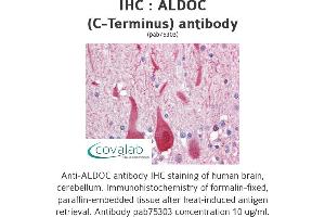 Image no. 1 for anti-Aldolase C, Fructose-Bisphosphate (ALDOC) (C-Term) antibody (ABIN2852410) (ALDOC antibody  (C-Term))