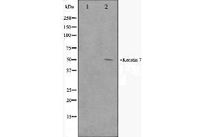 Western blot analysis on HepG2 cell lysate using Keratin 7 Antibody (Cytokeratin 7 antibody  (C-Term))