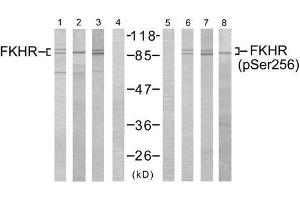 Western blot analysis using FKHR (Ab-256) antibody (E021138, Lane 1, 2, 3 and 4) and FKHR (phospho- Ser256)antibody (E011115, Lane 5, 6, 7 and 8). (FOXO1 antibody  (pSer256))