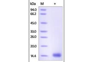 Human Cystatin D, His Tag on SDS-PAGE under reducing (R) condition. (CST5 Protein (AA 21-142) (His tag))