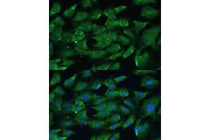 Immunofluorescence analysis of C6 cells using SHP2 antibody (ABIN6131893, ABIN6146440, ABIN6146441 and ABIN7101402) at dilution of 1:100. (PTPN11 antibody  (AA 1-460))