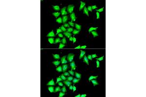 Immunofluorescence analysis of HeLa cell using MSRB1 antibody.