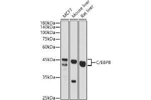 Western blot analysis of extracts of various cell lines, using C/EBPB antibody (ABIN6134025, ABIN6138382, ABIN6138383 and ABIN6213964) at 1:500 dilution.