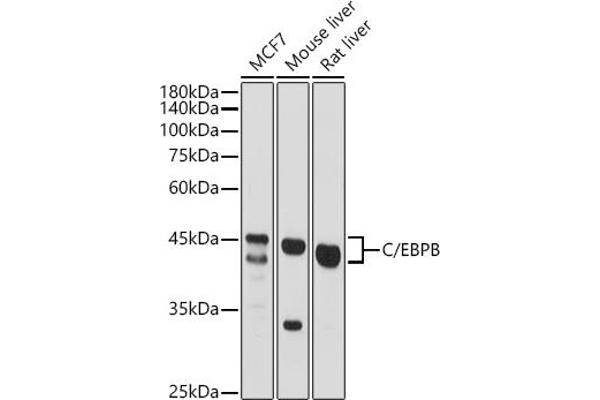 CEBPB anticorps  (AA 150-250)
