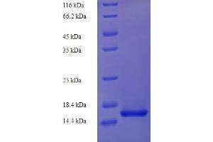 SDS-PAGE (SDS) image for Vascular Endothelial Growth Factor C (VEGFC) (AA 108-223) protein (His tag) (ABIN5713940) (VEGFC Protein (AA 108-223) (His tag))
