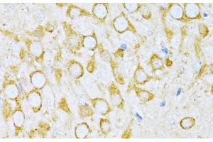 Immunohistochemistry of paraffin-embedded Rat brain using VARS Polyclonal Antibody at dilution of 1:100 (40x lens). (VARS antibody)