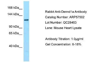 Western Blotting (WB) image for anti-DENN/MADD Domain Containing 1A (DENND1A) (C-Term) antibody (ABIN2787247) (DENND1A antibody  (C-Term))