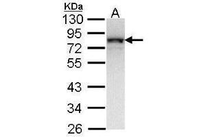 WB Image Sample (30 ug of whole cell lysate) A: Molt-4 , 12% SDS PAGE antibody diluted at 1:1000 (NDUFS1 antibody  (Center))